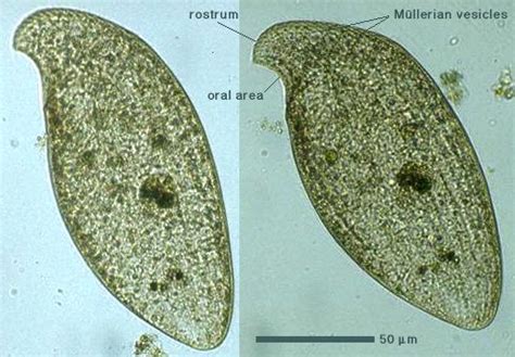  Loxodes: Một Vị Khách Lạ Cuối Cùng Nổi Bật Trong Giới Protists!